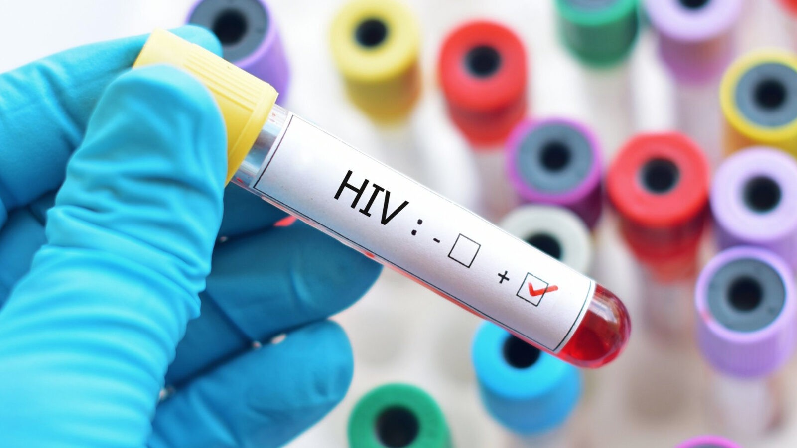 CA37 HIV Testing